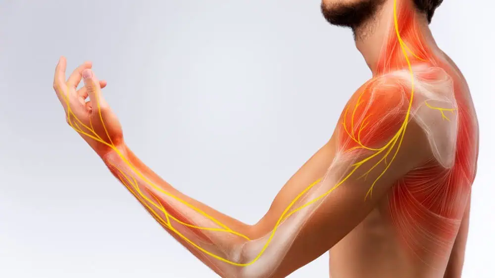 Nerve Problems